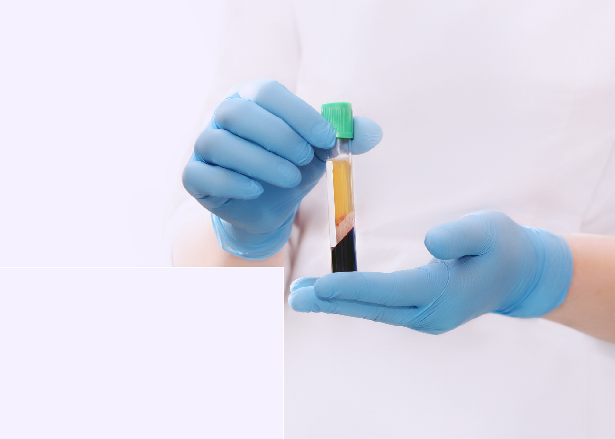 PRP 