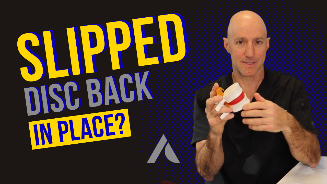 How Do I Get a Slipped Disc Back in Place? Albano Clinic